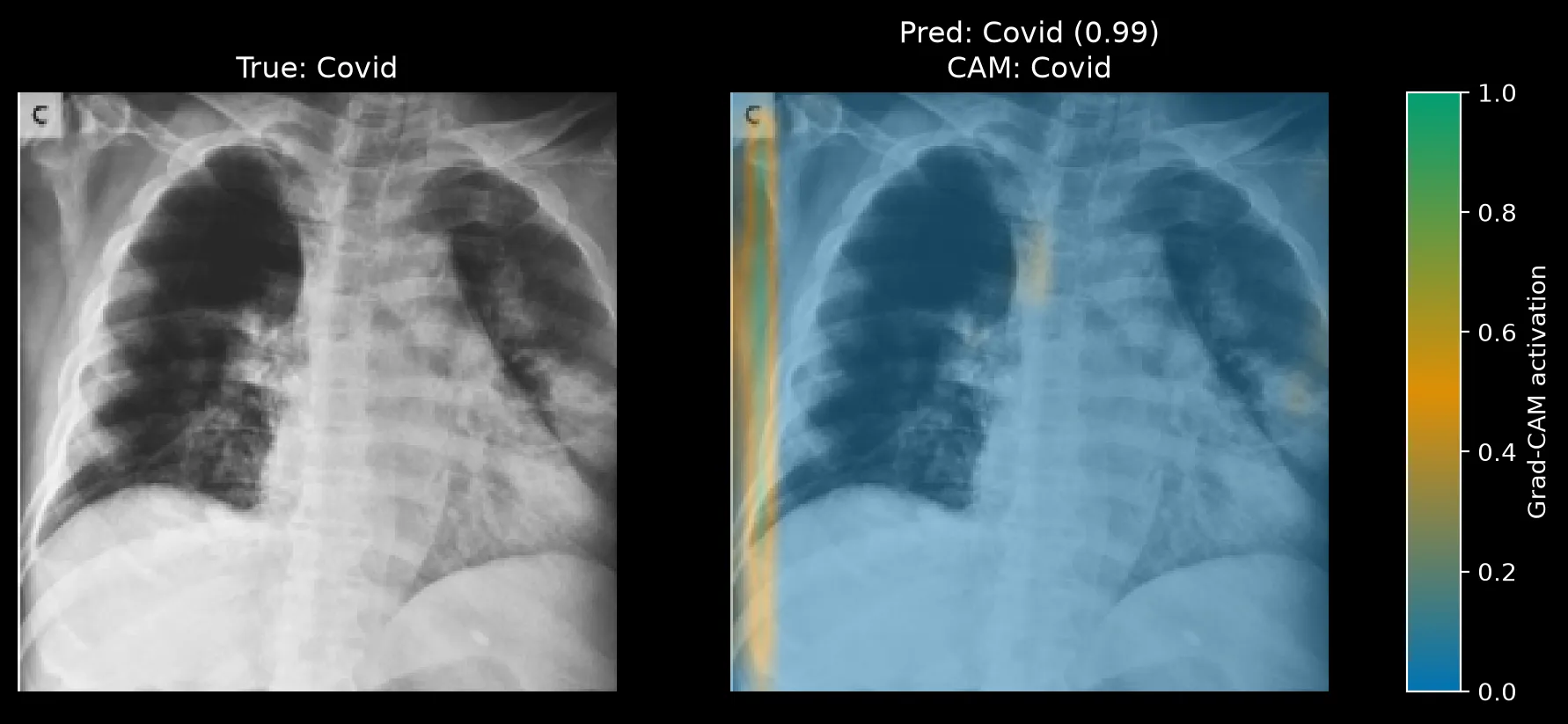 Grad-CAM for a Covid image predicted Covid at 0.99, with a vertical strip of green and orange activation along the left edge.