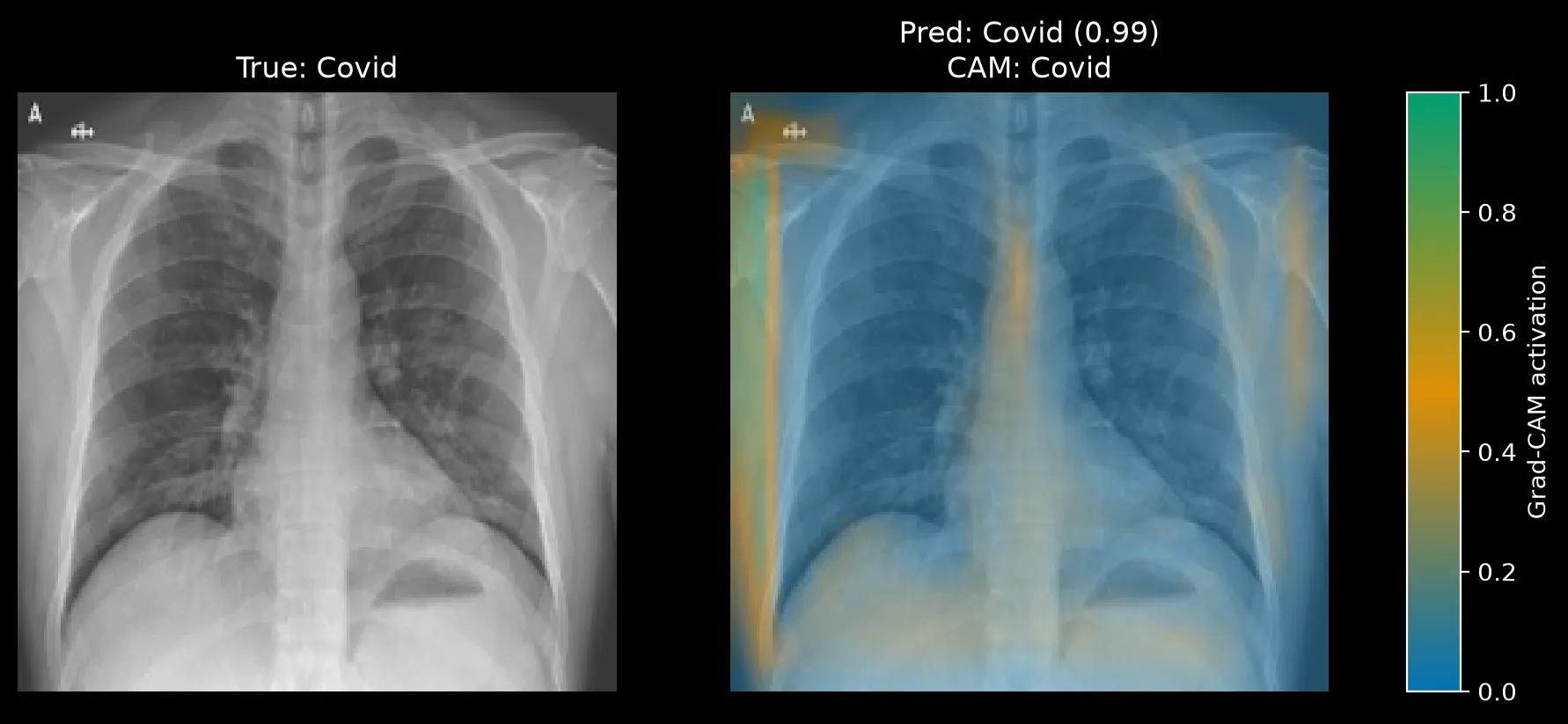 Grad-CAM for a Covid image predicted Covid at 0.99, with a left-edge strip, a top-left patch near a marker, and thin bands on the right side.