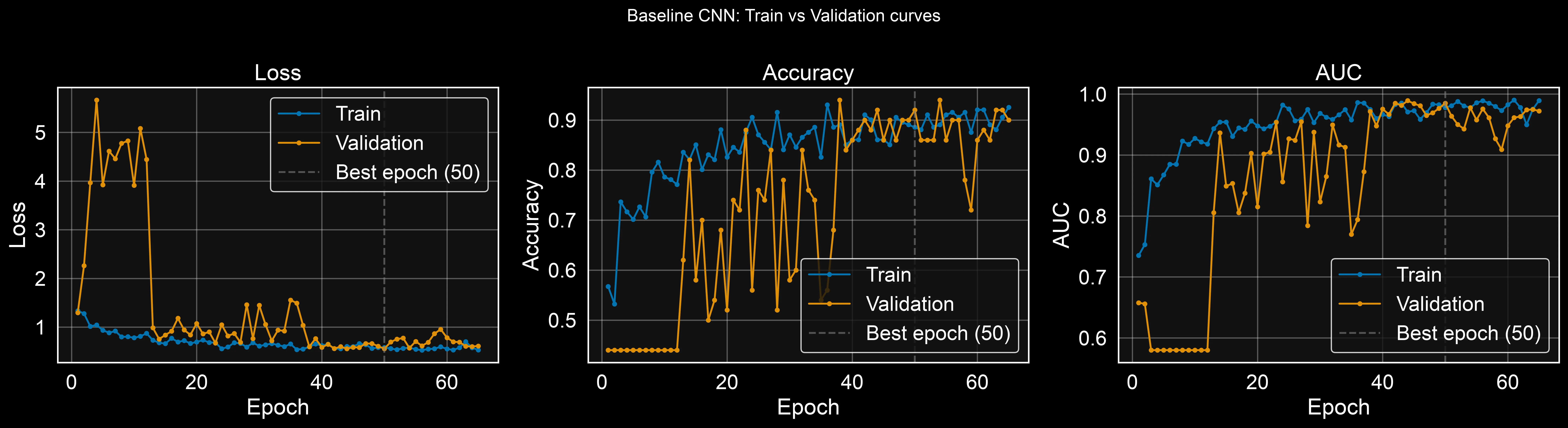 Training vs validation curves for loss, accuracy, and AUC across 65 epochs, with a vertical dashed line marking the best epoch at 50.